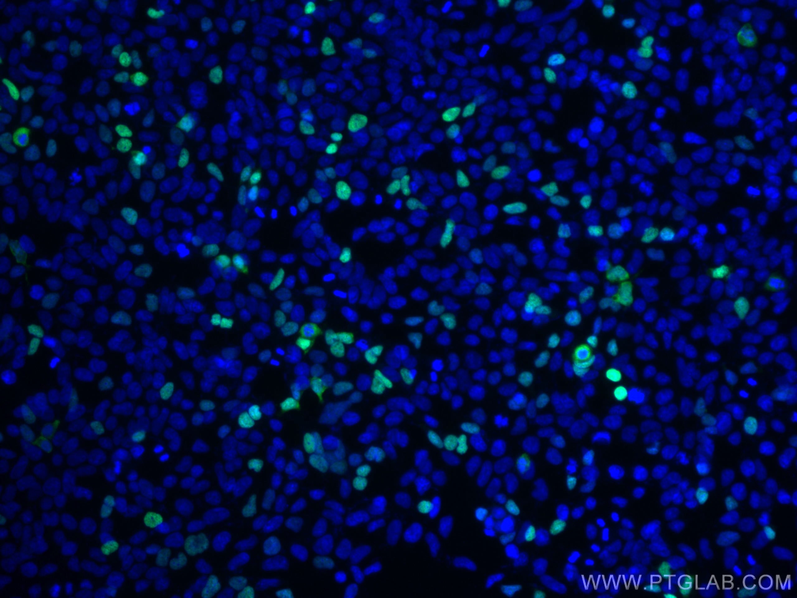 Immunofluorescence (IF) / fluorescent staining of Transfected HEK-293 cells using CoraLite® Plus 488-conjugated DYKDDDDK Monoclonal  (CL488-66008)
