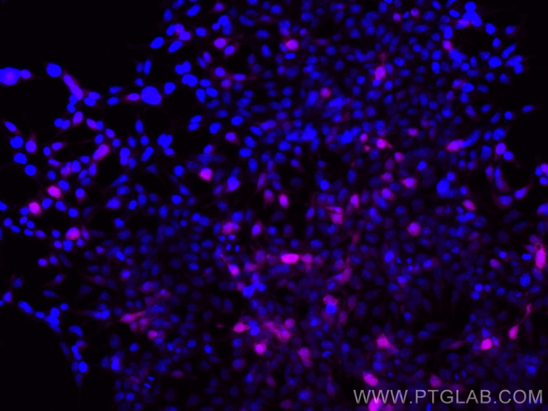 Immunofluorescence (IF) / fluorescent staining of Transfected HEK-293 cells using CoraLite® Plus 647-conjugated DYKDDDDK tag Monoclo (CL647-66008)