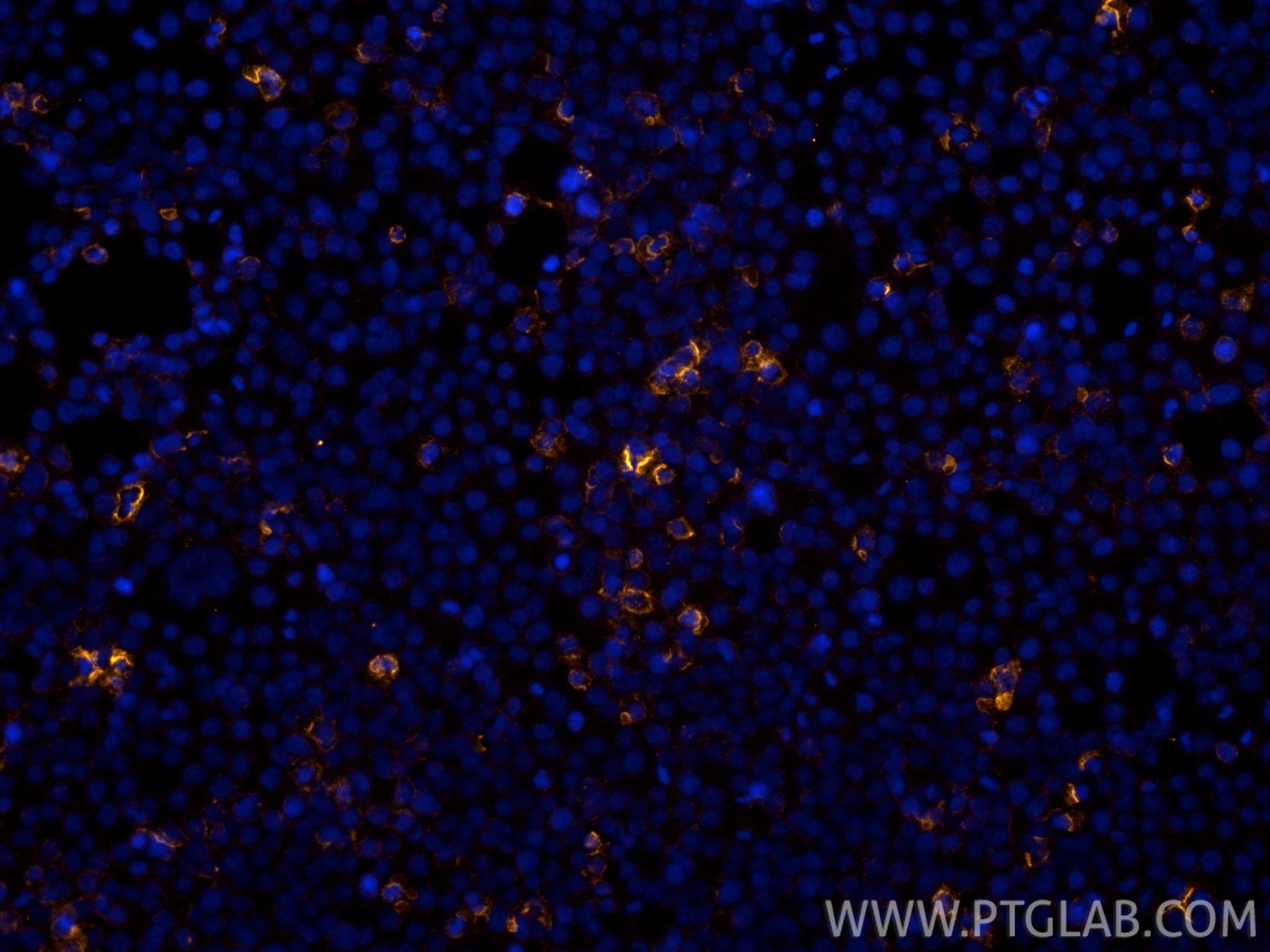 Flag tag antibody (PY7-FcA98449) | Proteintech
