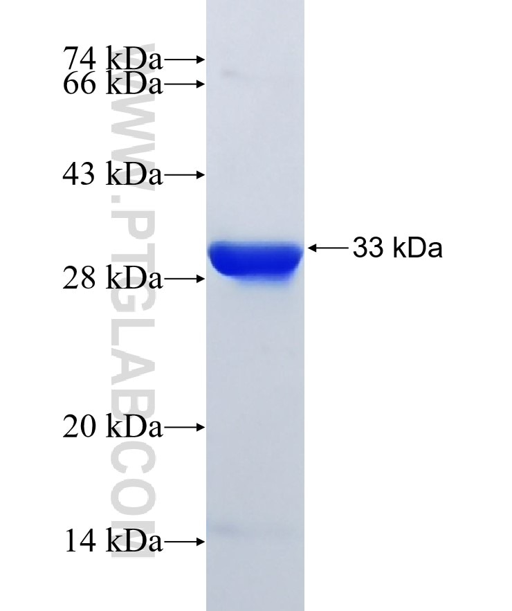 DYKDDDDK tag fusion protein Ag2329 SDS-PAGE