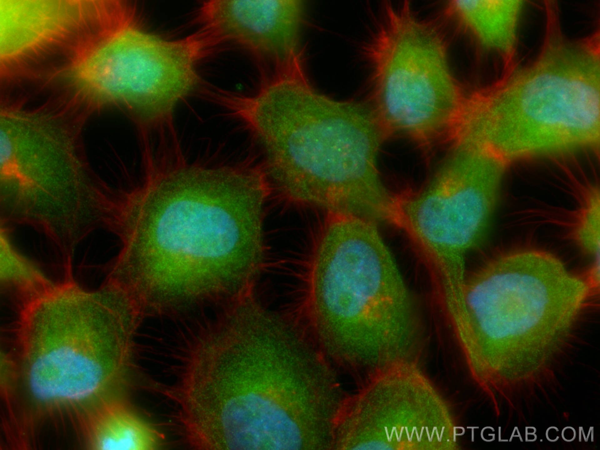 Immunofluorescence (IF) / fluorescent staining of A431 cells using Flightless I Polyclonal antibody (27729-1-AP)