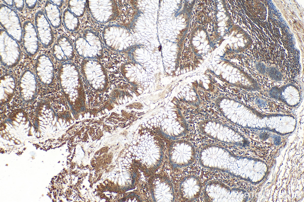 Immunohistochemistry (IHC) staining of human colon tissue using Flightless I Polyclonal antibody (27729-1-AP)