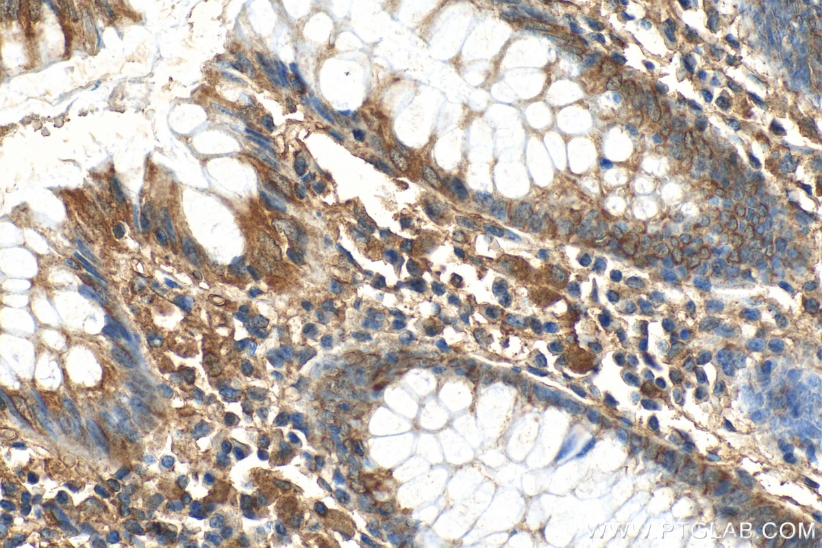 Immunohistochemistry (IHC) staining of human colon tissue using Flightless I Polyclonal antibody (27729-1-AP)