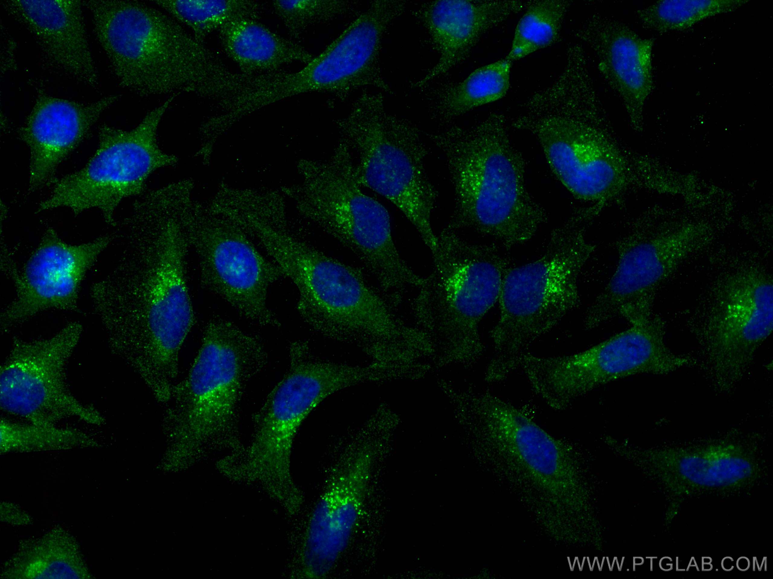 Immunofluorescence (IF) / fluorescent staining of HeLa cells using Flotillin 2 Polyclonal antibody (28208-1-AP)