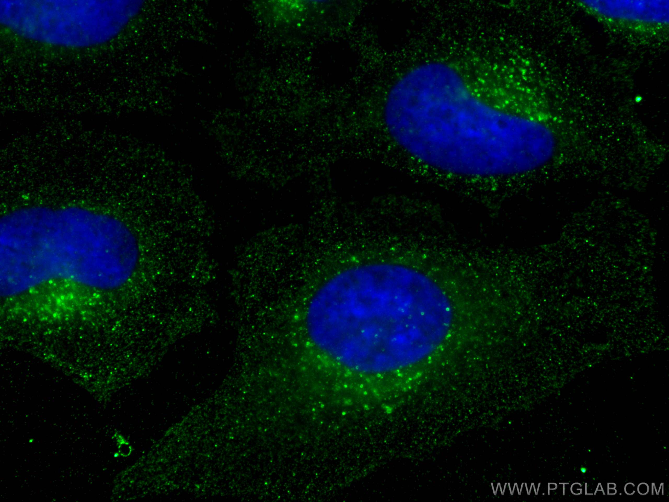 Immunofluorescence (IF) / fluorescent staining of HeLa cells using Flotillin 2 Monoclonal antibody (66881-1-Ig)