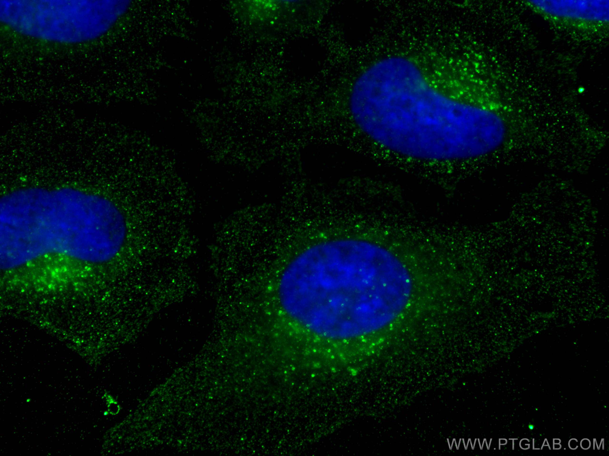 Immunofluorescence (IF) / fluorescent staining of HeLa cells using Flotillin 2 Monoclonal antibody (66881-1-Ig)
