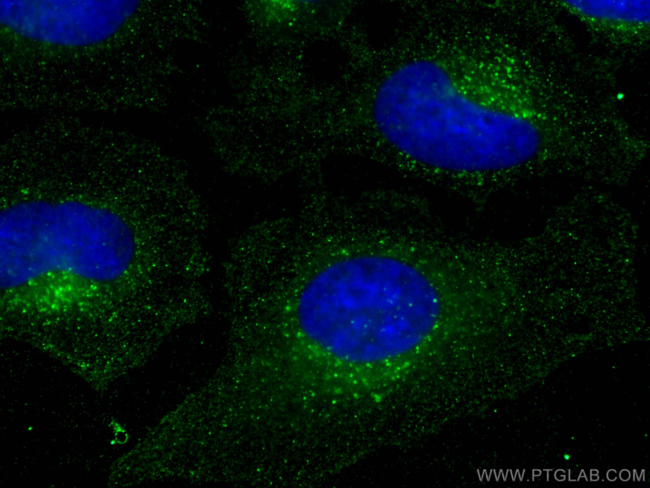 IF Staining of HeLa using 66881-1-Ig