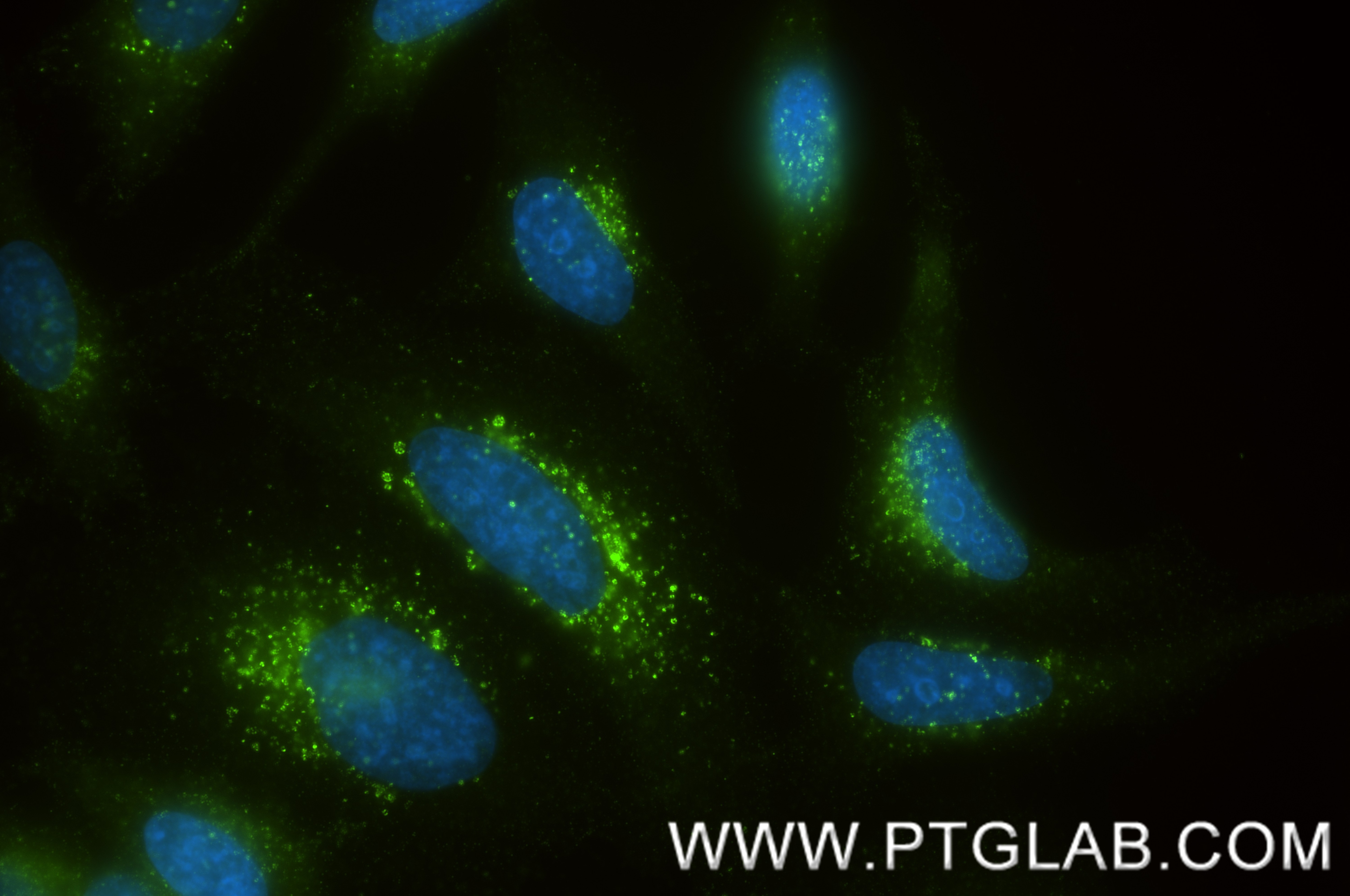 Immunofluorescence (IF) / fluorescent staining of HeLa cells using Flotillin 2 Recombinant monoclonal antibody (88149-1-RR)