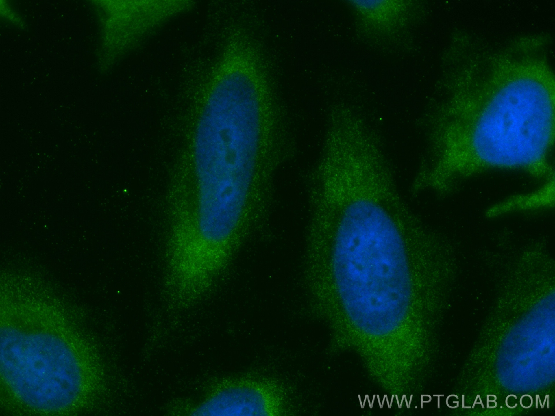 Immunofluorescence (IF) / fluorescent staining of HeLa cells using Follistatin Polyclonal antibody (27350-1-AP)