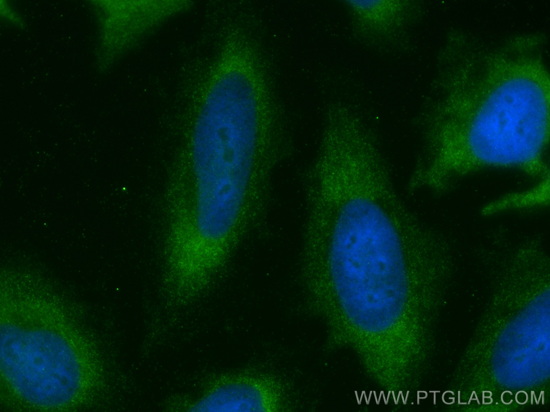 IF Staining of HeLa using 27350-1-AP