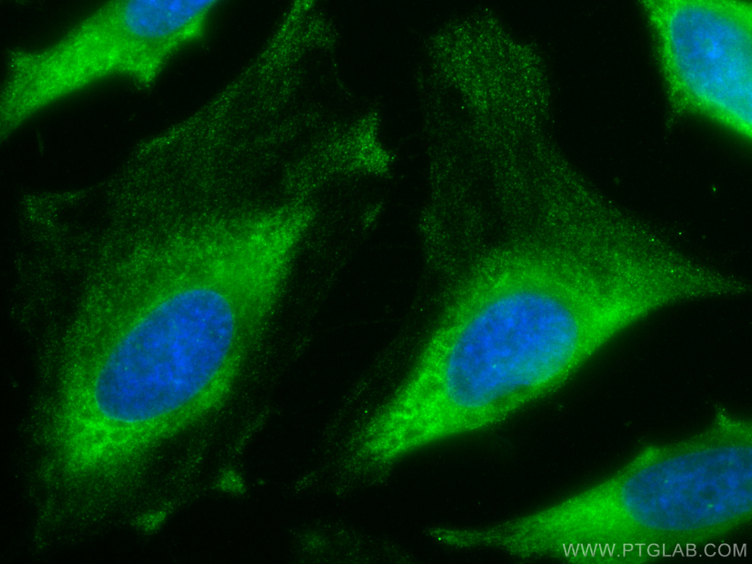 Immunofluorescence (IF) / fluorescent staining of HeLa cells using CoraLite® Plus 488-conjugated Follistatin Monoclon (CL488-60060)