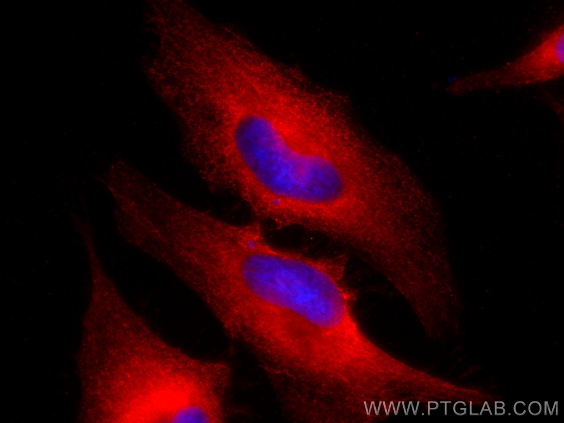 IF Staining of HeLa using CL594-60060