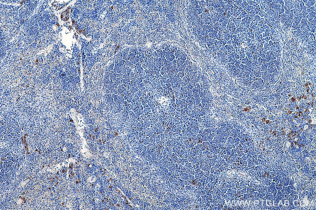Immunohistochemistry (IHC) staining of mouse spleen tissue using Anti-Mouse Foxp3 (3G3) (65089-1-Ig)