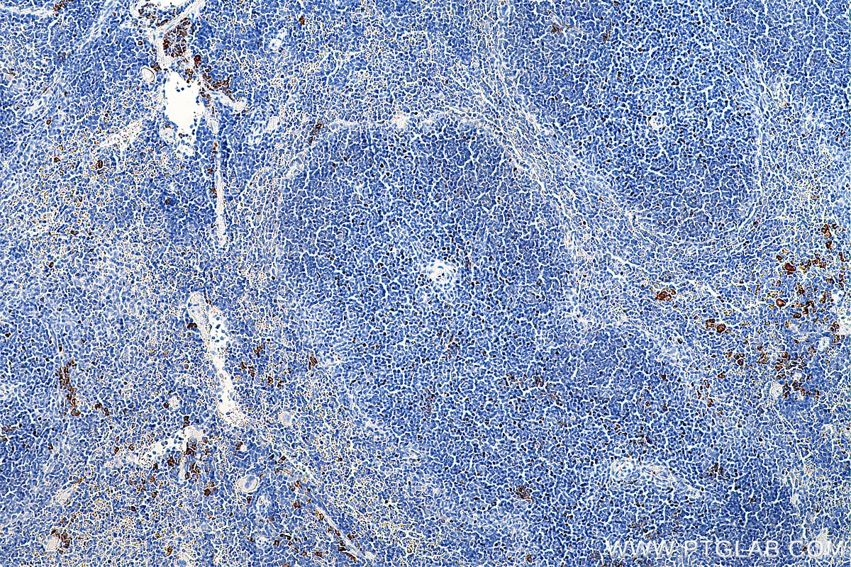 IHC staining of mouse spleen using 65089-1-Ig