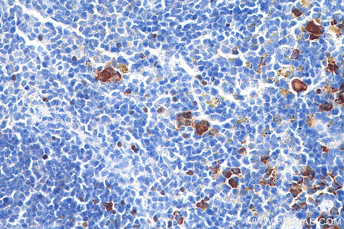 Immunohistochemistry (IHC) staining of mouse spleen tissue using Anti-Mouse Foxp3 (3G3) (65089-1-Ig)