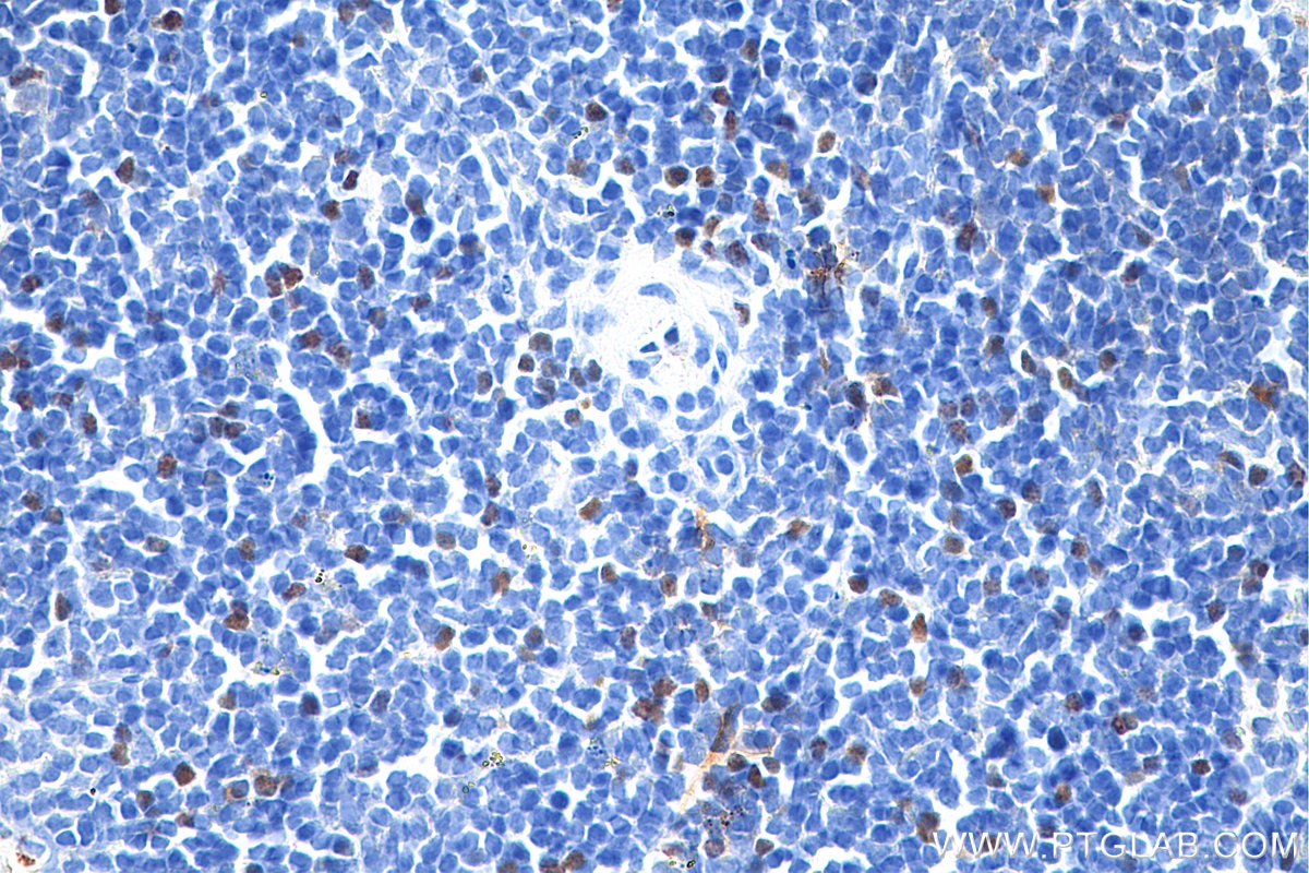 Immunohistochemistry (IHC) staining of mouse spleen tissue using Anti-Mouse Foxp3 (3G3) (65089-1-Ig)