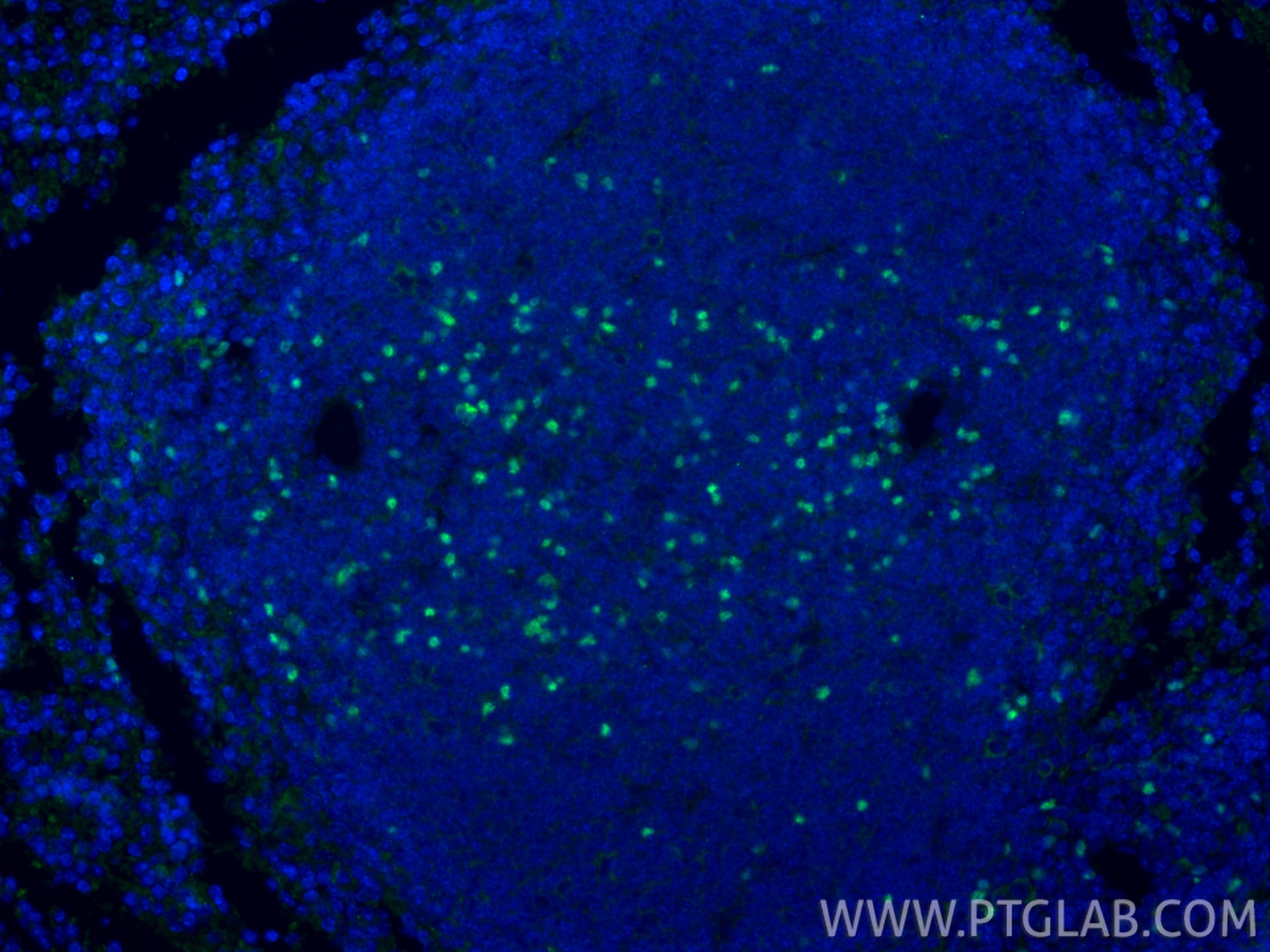 Immunofluorescent analysis of (4% PFA) fixed paraffin-embedded mouse spleen tissue using Foxp3 antibody (85128-6-RR, Clone: 242853G11 ) at dilution of 1:1000 and CoraLite®488-Conjugated Goat Anti-Rabbit IgG(H+L) (SA00013-2). Heat mediated antigen retrieval with Tris-EDTA buffer (pH 9.0). Immunofluorescence (IF) / fluorescent staining of mouse spleen tissue using Foxp3 Recombinant antibody (85128-6-RR)
