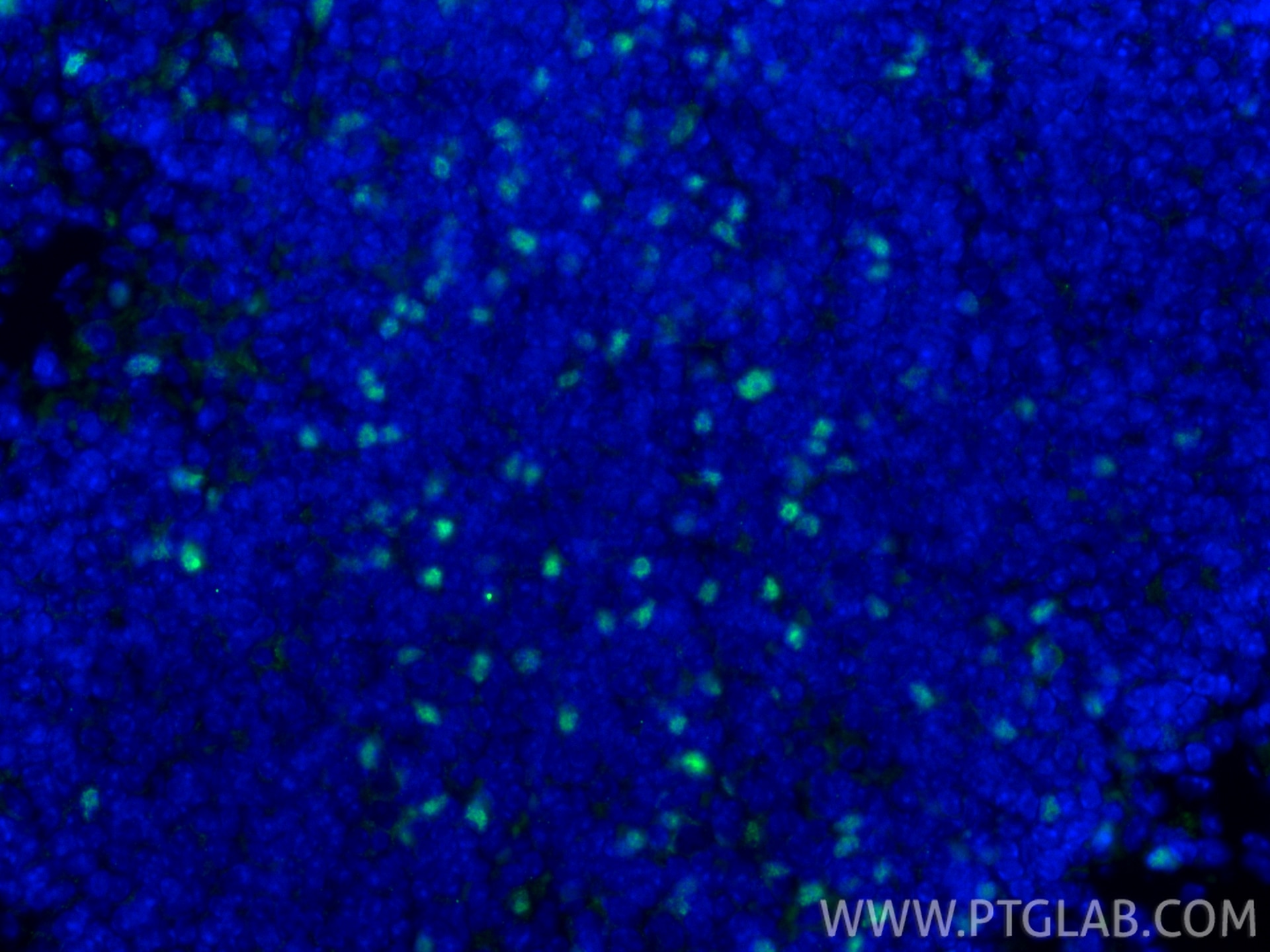 Immunofluorescent analysis of (4% PFA) fixed paraffin-embedded mouse spleen tissue using Foxp3 antibody (85128-6-RR, Clone: 242853G11 ) at dilution of 1:1000 and CoraLite®488-Conjugated Goat Anti-Rabbit IgG(H+L) (SA00013-2). Heat mediated antigen retrieval with Tris-EDTA buffer (pH 9.0). Immunofluorescence (IF) / fluorescent staining of mouse spleen tissue using Foxp3 Recombinant antibody (85128-6-RR)