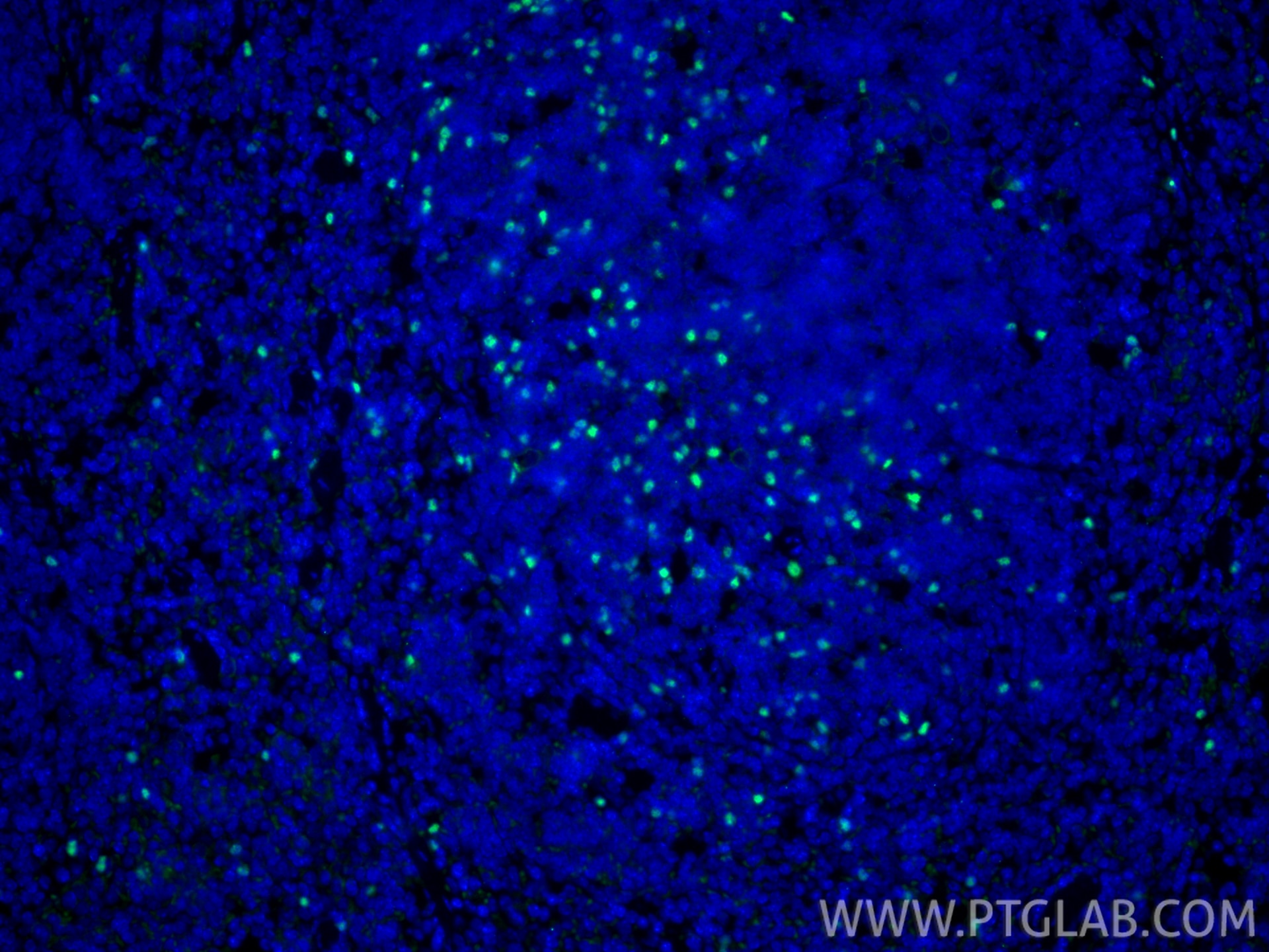 Immunofluorescent analysis of (4% PFA) fixed frozen OCT-embedded mouse spleen tissue using Foxp3 antibody (85128-6-RR, Clone: 242853G11 ) at dilution of 1:500 and CoraLite®488-Conjugated Goat Anti-Rabbit IgG(H+L) (SA00013-2). Immunofluorescence (IF) / fluorescent staining of mouse spleen tissue using Foxp3 Recombinant monoclonal antibody (85128-6-RR)