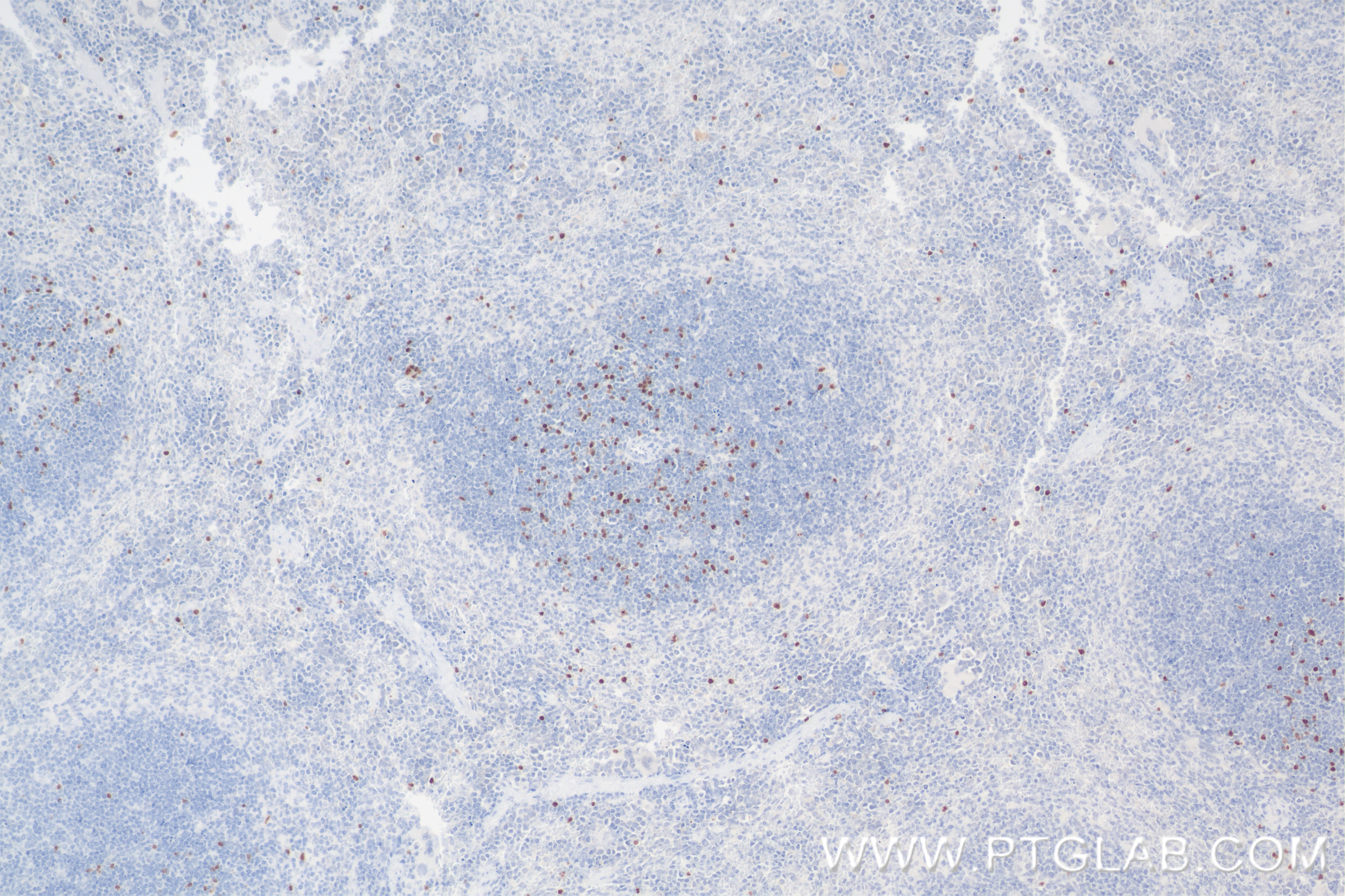 Immunohistochemistry (IHC) staining of mouse spleen tissue using Foxp3 Recombinant antibody (85128-6-RR)