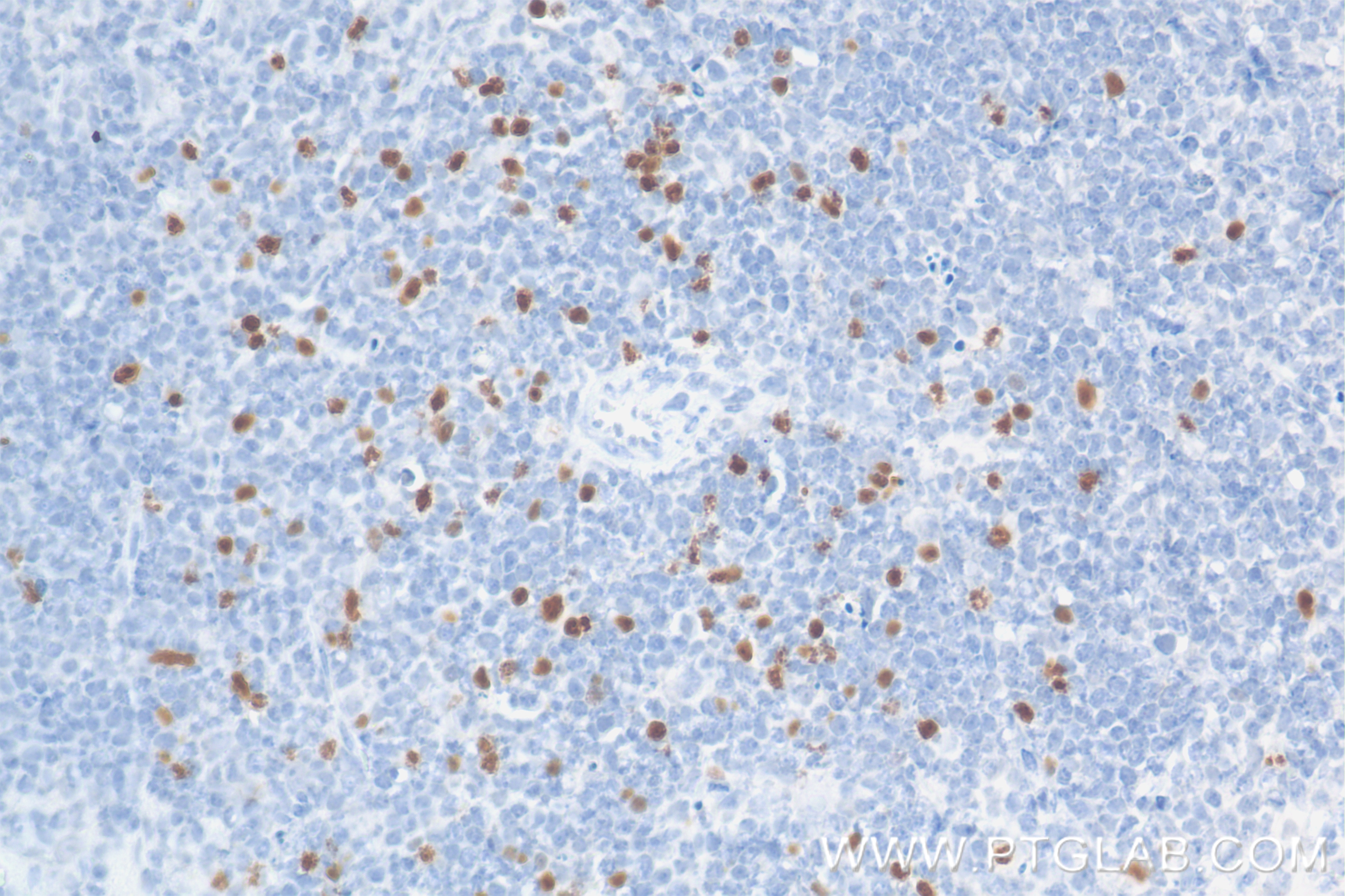 Immunohistochemistry (IHC) staining of mouse spleen tissue using Foxp3 Recombinant antibody (85128-6-RR)