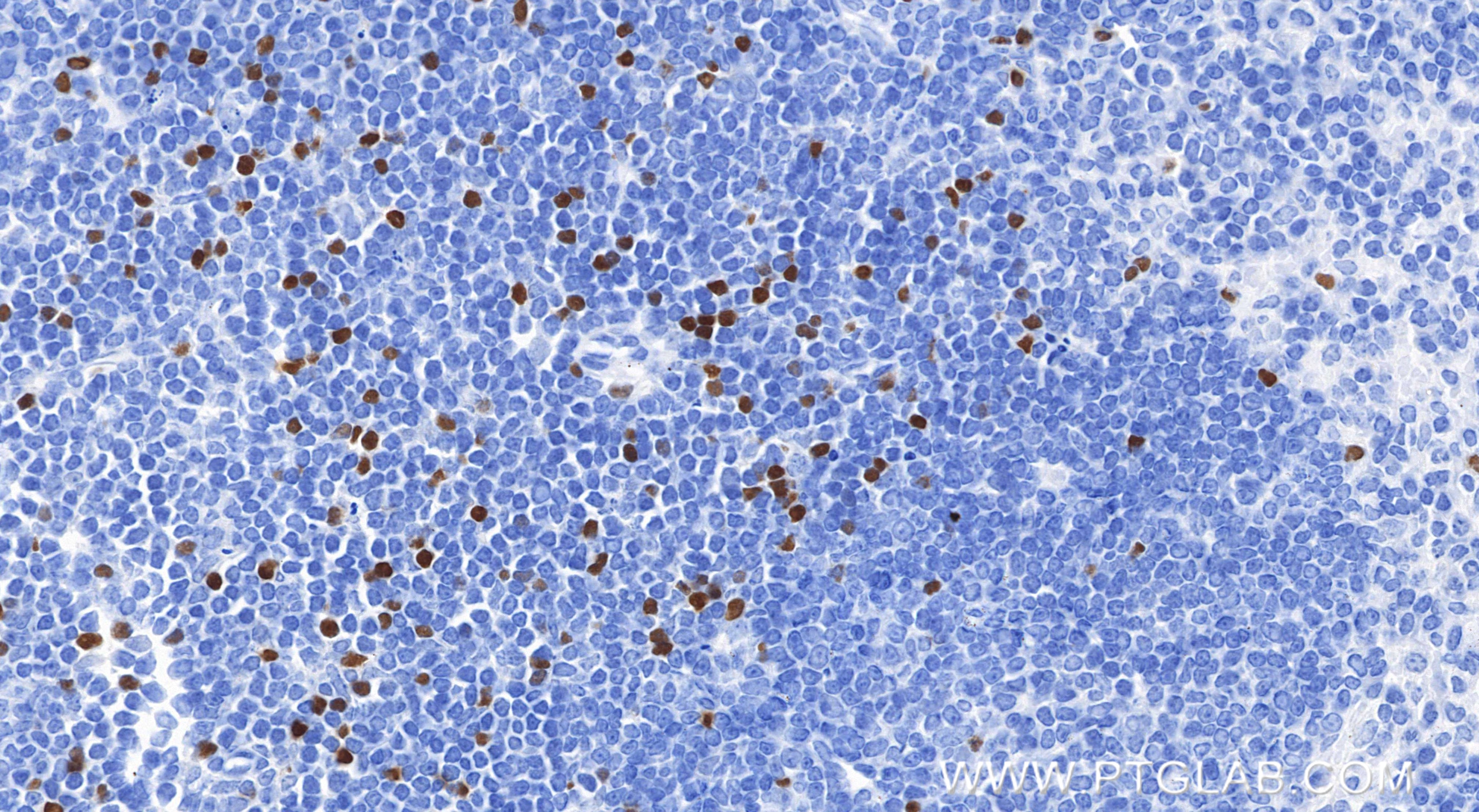Immunohistochemical analysis of paraffin-embedded mouse spleen tissue slide using 85128-6-RR (Foxp3 antibody) at dilution of 1:1000 (under 40x lens). Heat mediated antigen retrieval with Tris-EDTA buffer (pH 9.0). Immunohistochemistry (IHC) staining of mouse spleen tissue using Foxp3 Recombinant monoclonal antibody (85128-6-RR)