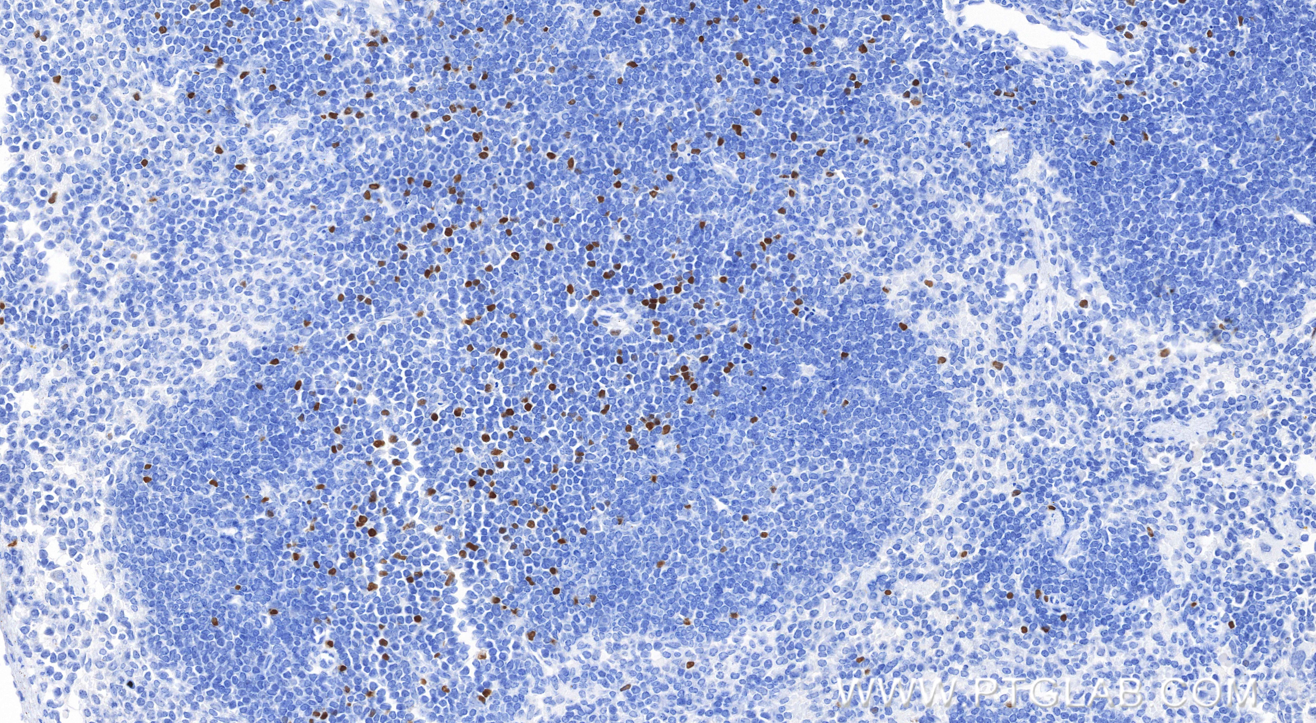 Immunohistochemical analysis of paraffin-embedded mouse spleen tissue slide using 85128-6-RR (Foxp3 antibody) at dilution of 1:1000 (under 20x lens). Heat mediated antigen retrieval with Tris-EDTA buffer (pH 9.0). Immunohistochemistry (IHC) staining of mouse spleen tissue using Foxp3 Recombinant monoclonal antibody (85128-6-RR)