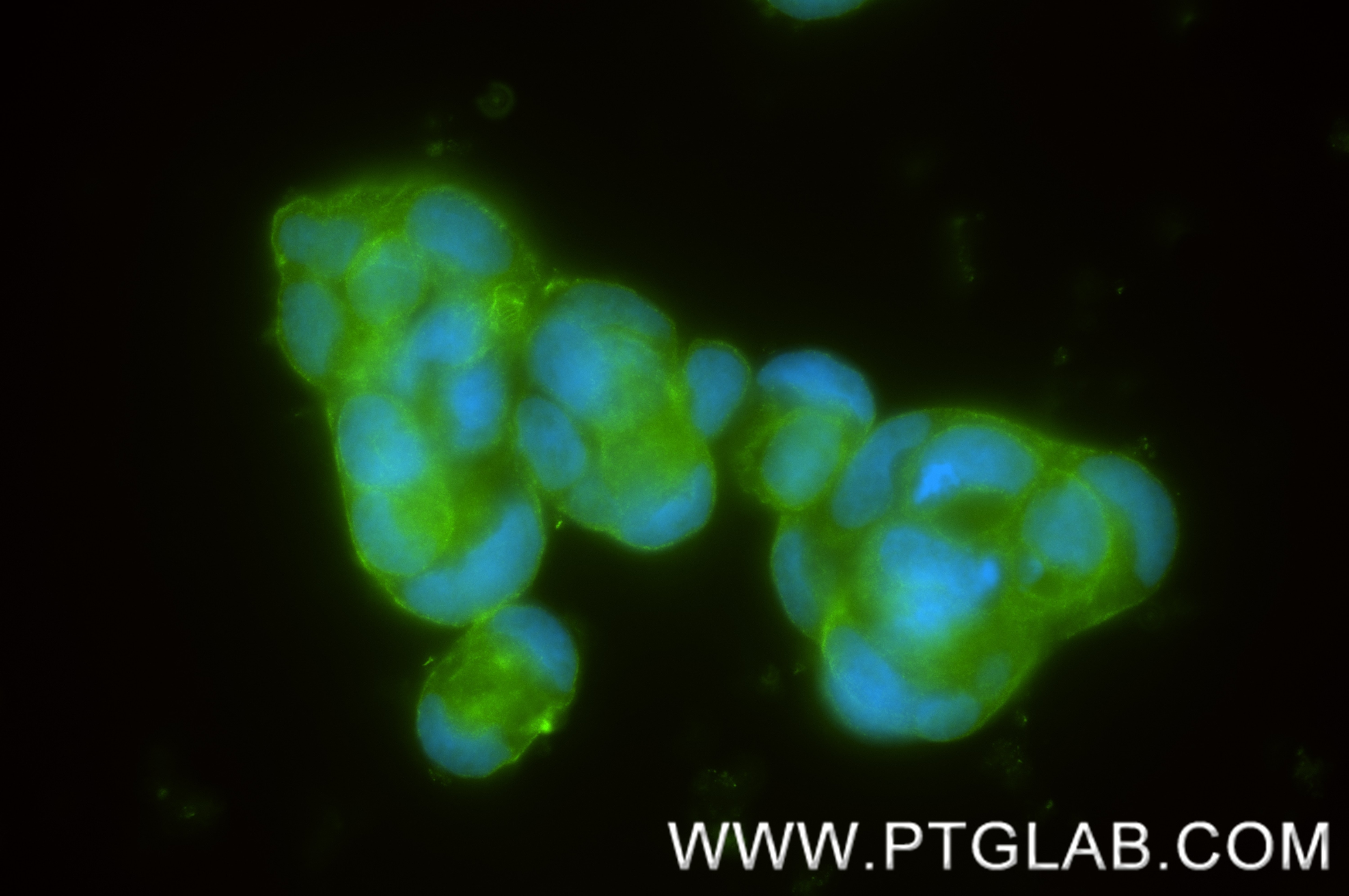 Immunofluorescence (IF) / fluorescent staining of Caco-2 cells using Frizzled 10 Recombinant monoclonal antibody (85829-2-RR)