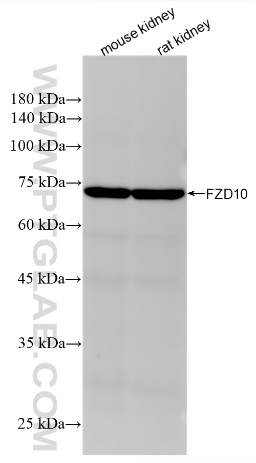 Western Blot (WB) analysis of various lysates using Frizzled 10 Recombinant monoclonal antibody (85829-2-RR)
