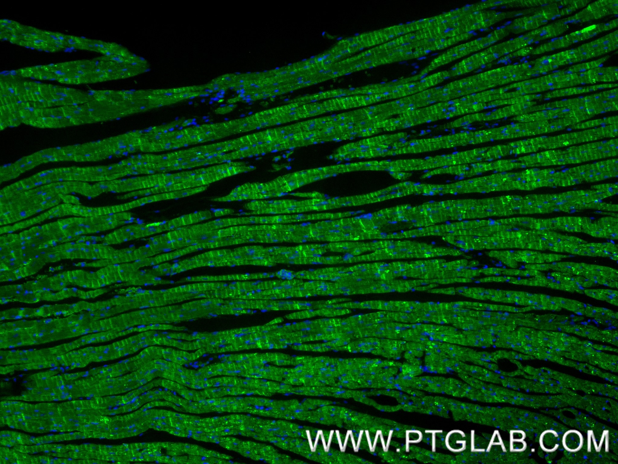 Immunofluorescence (IF) / fluorescent staining of mouse heart tissue using Frizzled 4 Recombinant monoclonal antibody (87975-1-RR)