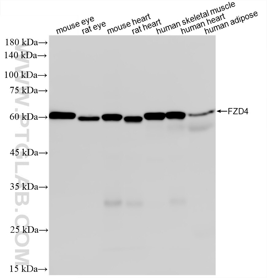 WB analysis using 87975-1-RR (same clone as 87975-1-PBS) Western Blot (WB) analysis of various lysates using Frizzled 4 Recombinant monoclonal antibody (87975-1-RR)