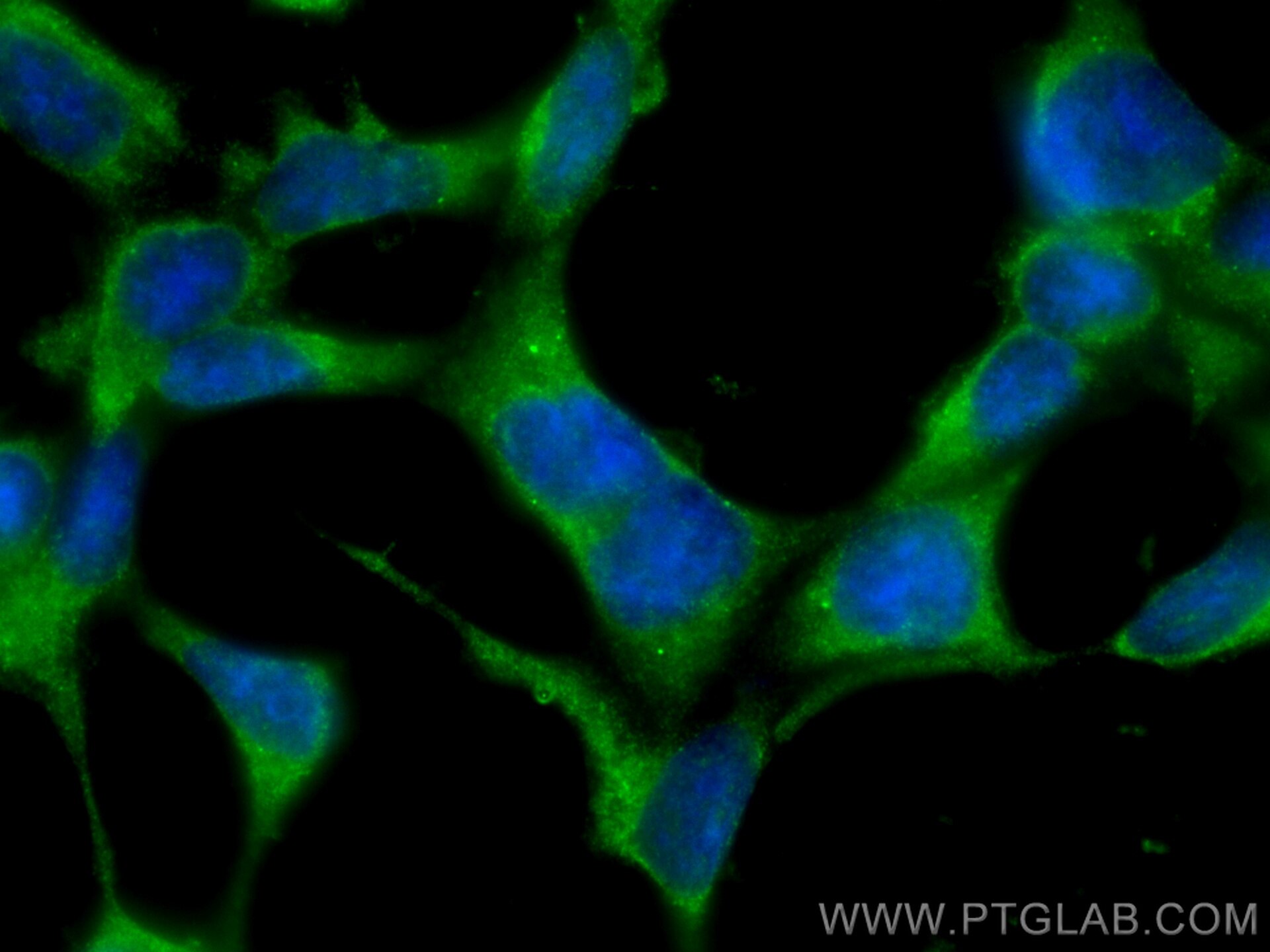 Immunofluorescence (IF) / fluorescent staining of HEK-293 cells using Frizzled 9 Monoclonal antibody (67023-1-Ig)