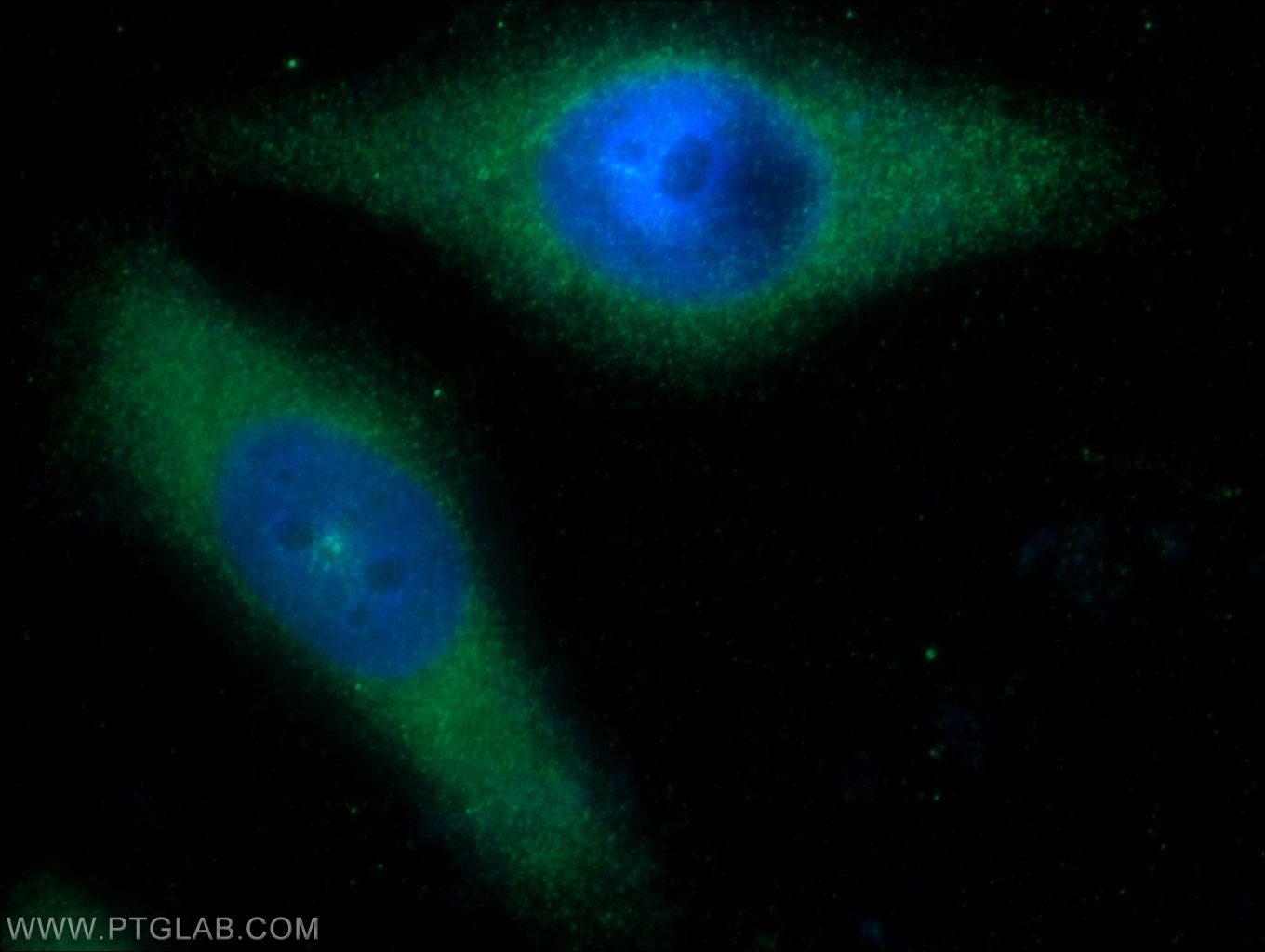 IF Staining of HeLa using 17185-1-AP