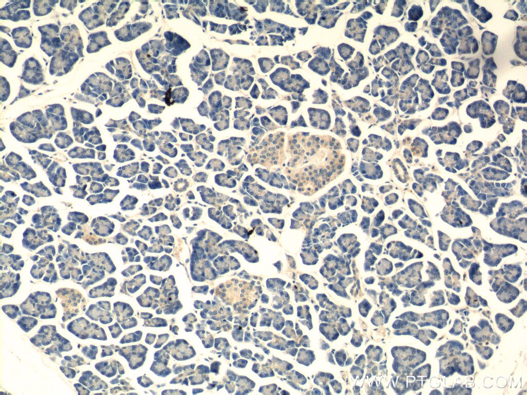 IHC staining of human pancreas using 17185-1-AP