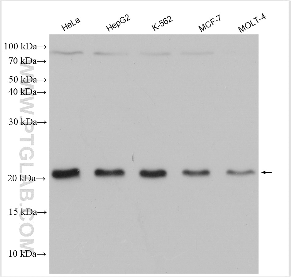 Western Blot (WB) analysis of various lysates using G-CSF Polyclonal antibody (17185-1-AP)