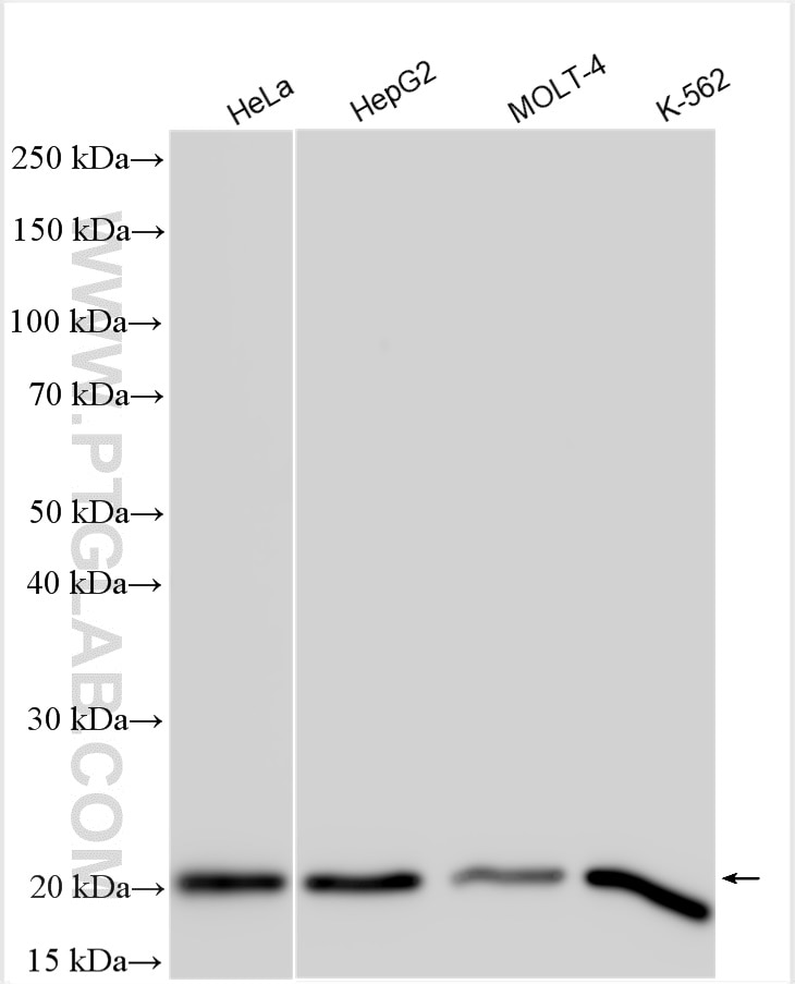 Western Blot (WB) analysis of various lysates using G-CSF Polyclonal antibody (17185-1-AP)