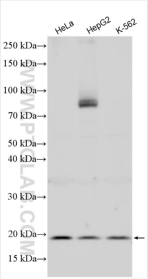 Western Blot (WB) analysis of various lysates using G-CSF Polyclonal antibody (30415-1-AP)