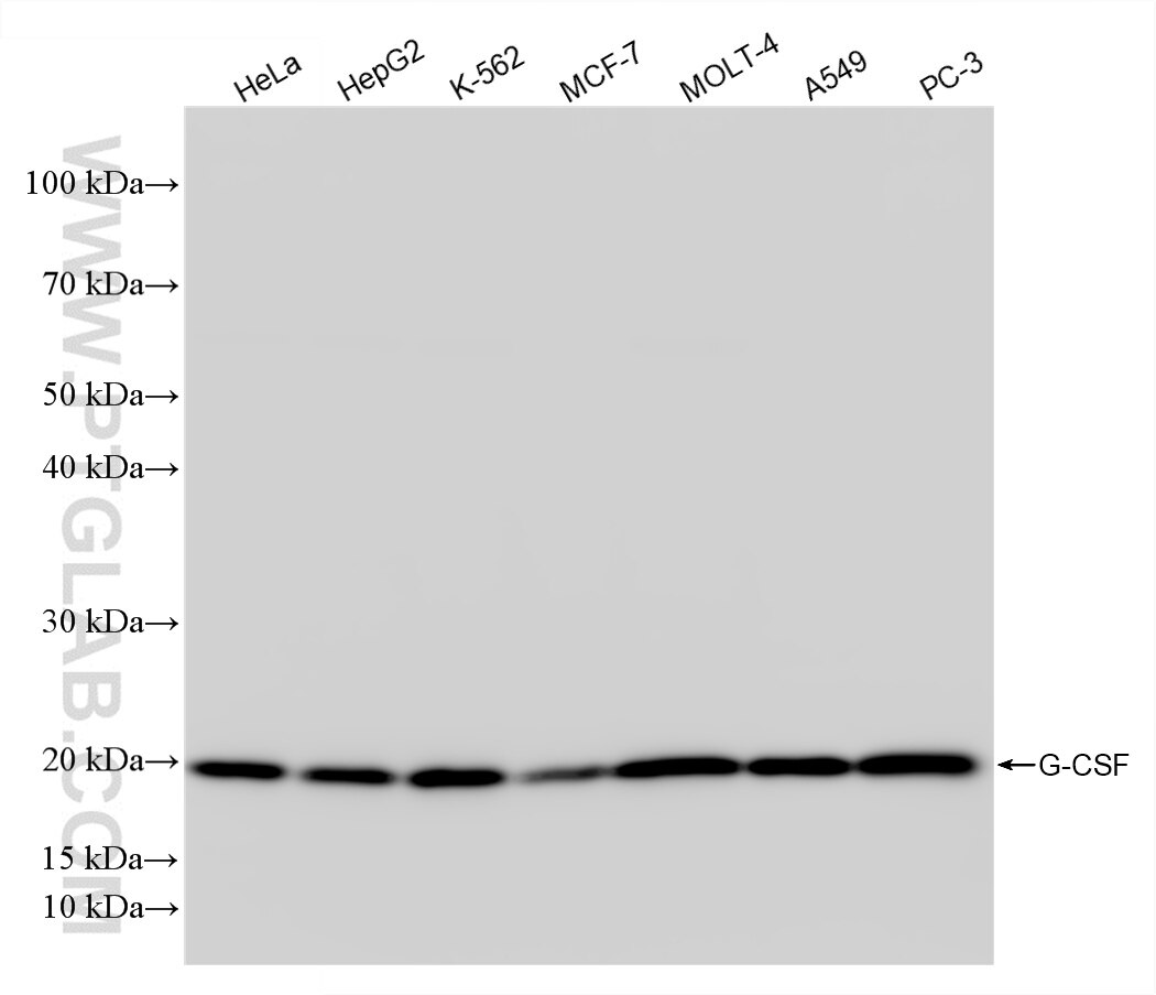 Various lysates were subjected to SDS PAGE followed by western blot with 86376-1-RR (G-CSF antibody) at dilution of 1:2000 incubated at room temperature for 1.5 hours. Western Blot (WB) analysis of various lysates using G-CSF Recombinant antibody (86376-1-RR)