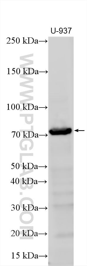 Western Blot (WB) analysis of various lysates using G-CSFR Polyclonal antibody (18310-1-AP)
