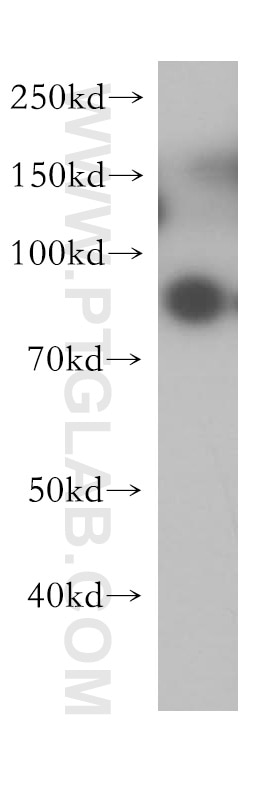 Western Blot (WB) analysis of human placenta tissue using G-CSFR Polyclonal antibody (18310-1-AP)