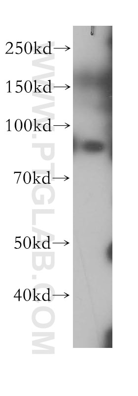 Western Blot (WB) analysis of human placenta tissue using G-CSFR Polyclonal antibody (18310-1-AP)