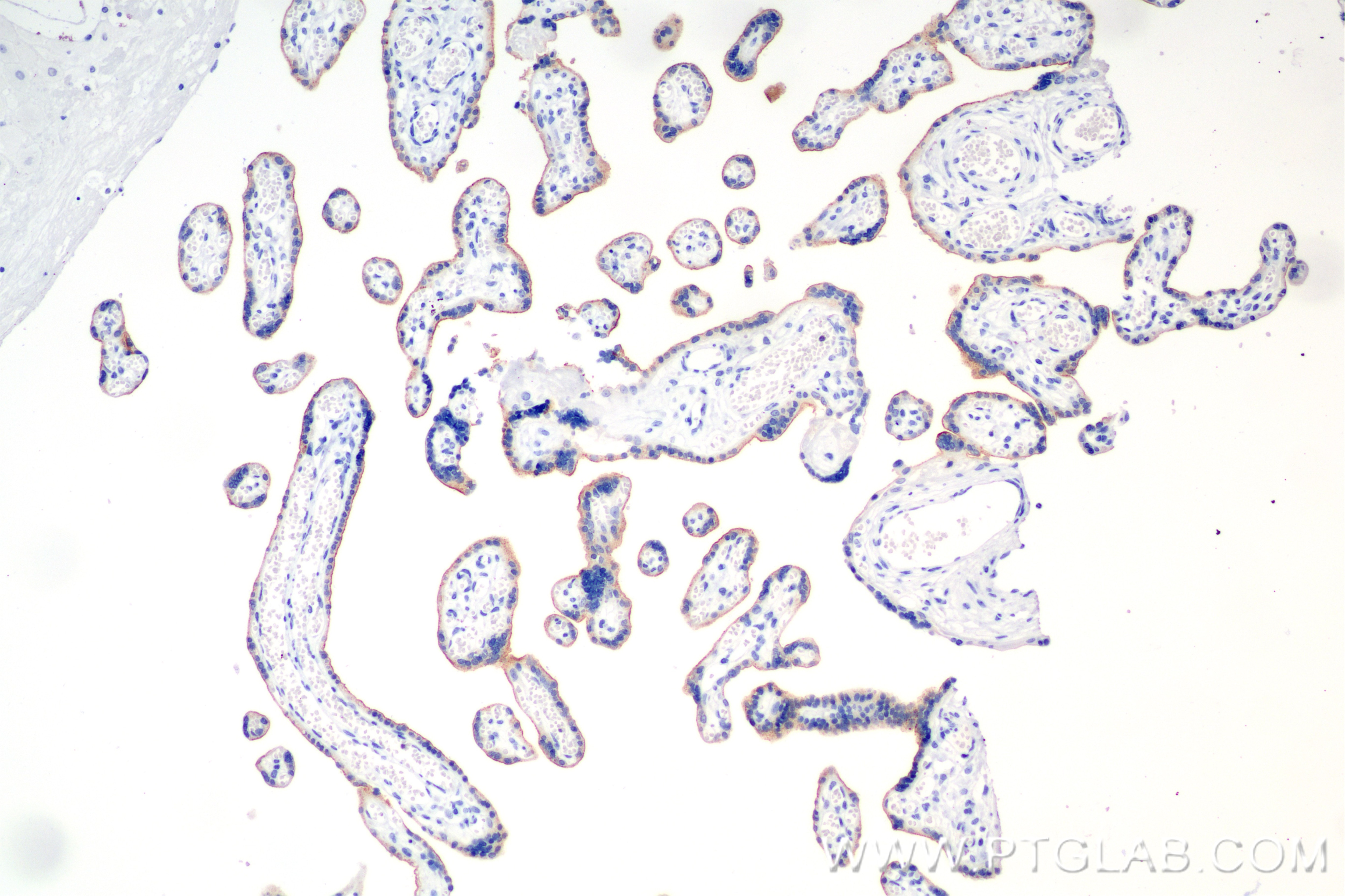 Immunohistochemistry (IHC) staining of human placenta tissue using G-CSFR Recombinant antibody (84827-2-RR)