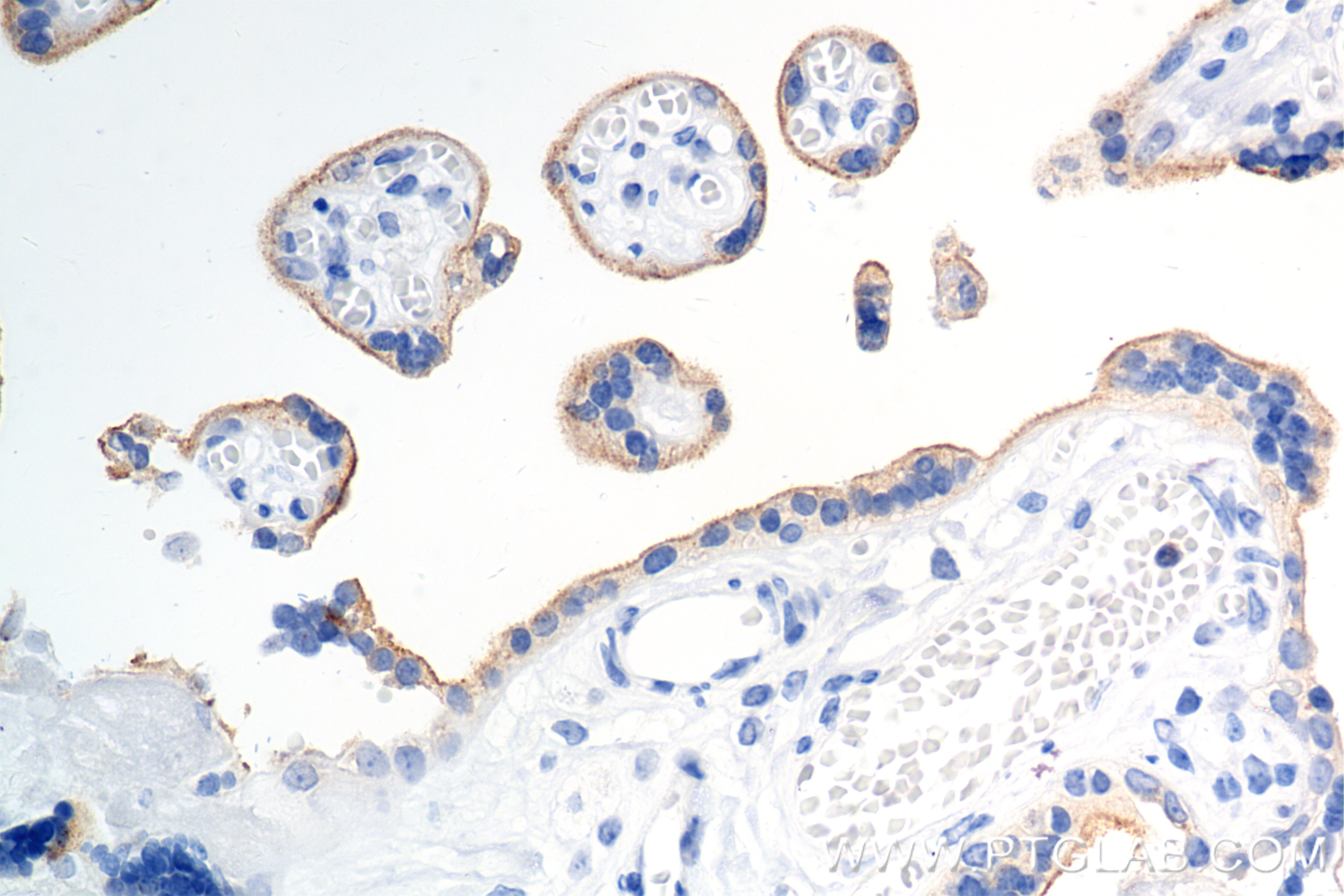 Immunohistochemistry (IHC) staining of human placenta tissue using G-CSFR Recombinant antibody (84827-2-RR)