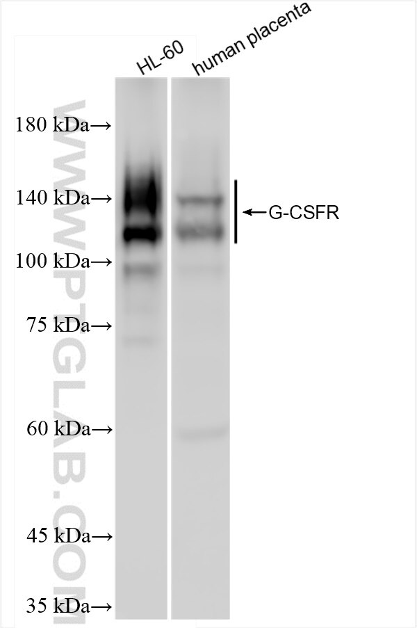 Western Blot (WB) analysis of various lysates using G-CSFR Recombinant antibody (84827-2-RR)