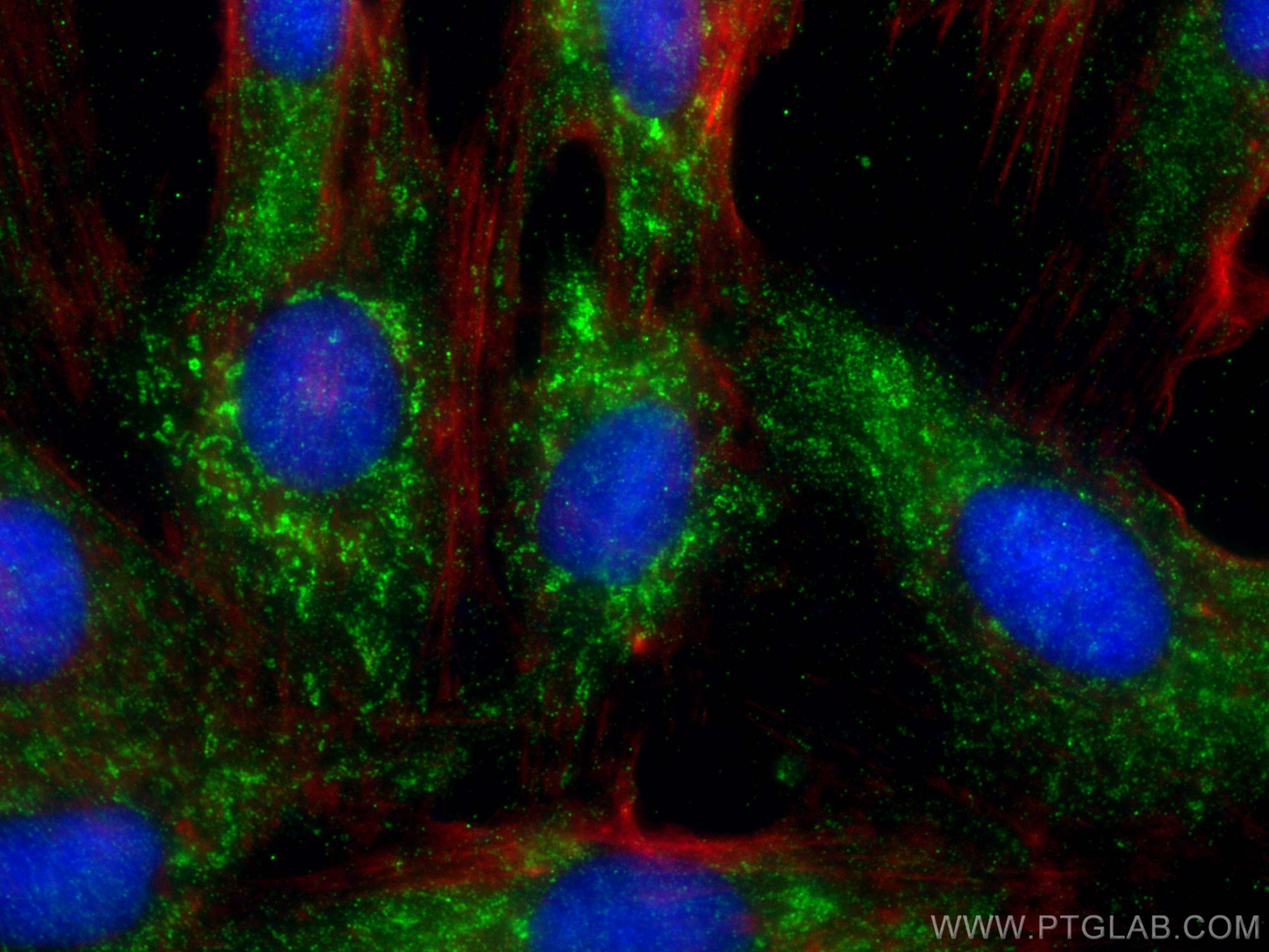 Immunofluorescence (IF) / fluorescent staining of H9C2 cells using G0S2 Polyclonal antibody (12091-1-AP)