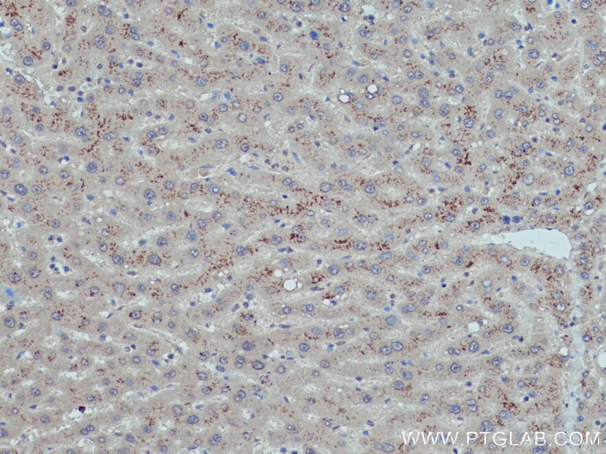 Immunohistochemistry (IHC) staining of human liver tissue using G0S2 Polyclonal antibody (12091-1-AP)