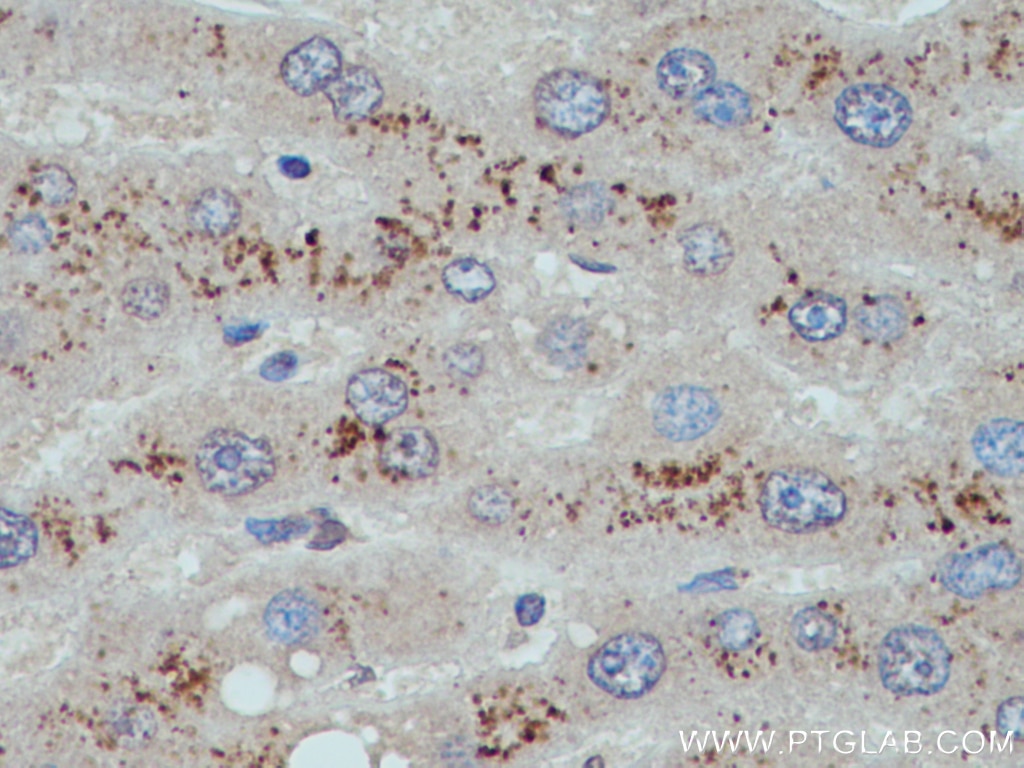 Immunohistochemistry (IHC) staining of human liver tissue using G0S2 Polyclonal antibody (12091-1-AP)