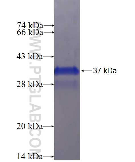 G0S2 fusion protein Ag2731 SDS-PAGE