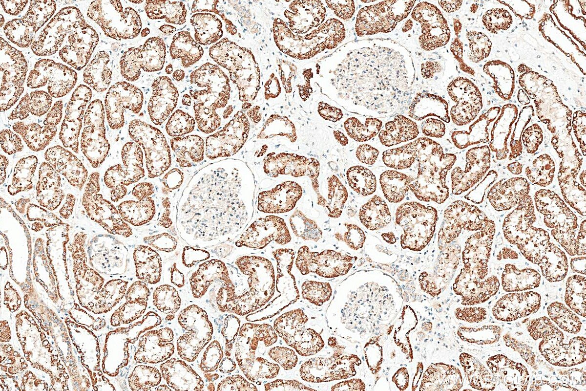 Immunohistochemistry (IHC) staining of human kidney tissue using G2E3 Polyclonal antibody (34058-1-AP)