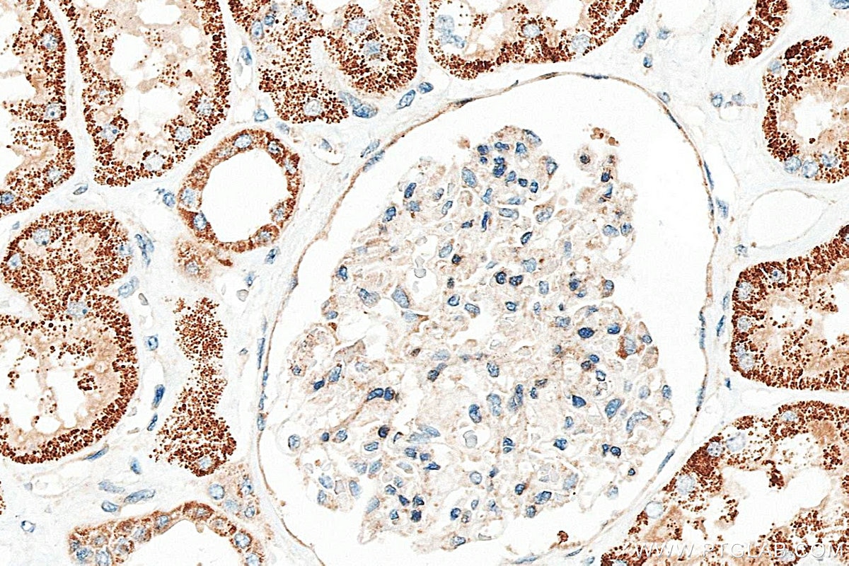 Immunohistochemistry (IHC) staining of human kidney tissue using G2E3 Polyclonal antibody (34058-1-AP)